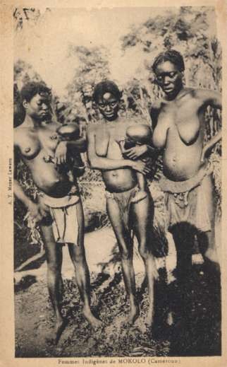 Black Nursing Mothers from Mokolo