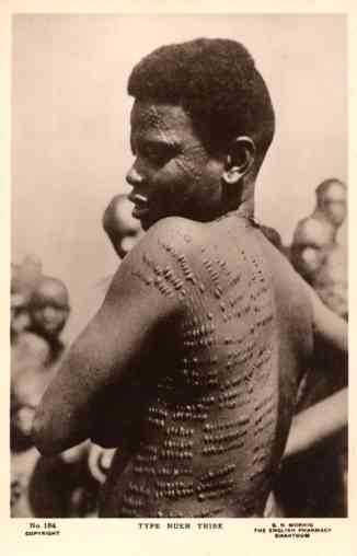 Black Tatooed Skin Sudan Real Photo