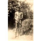 African Black Leper Real Photo